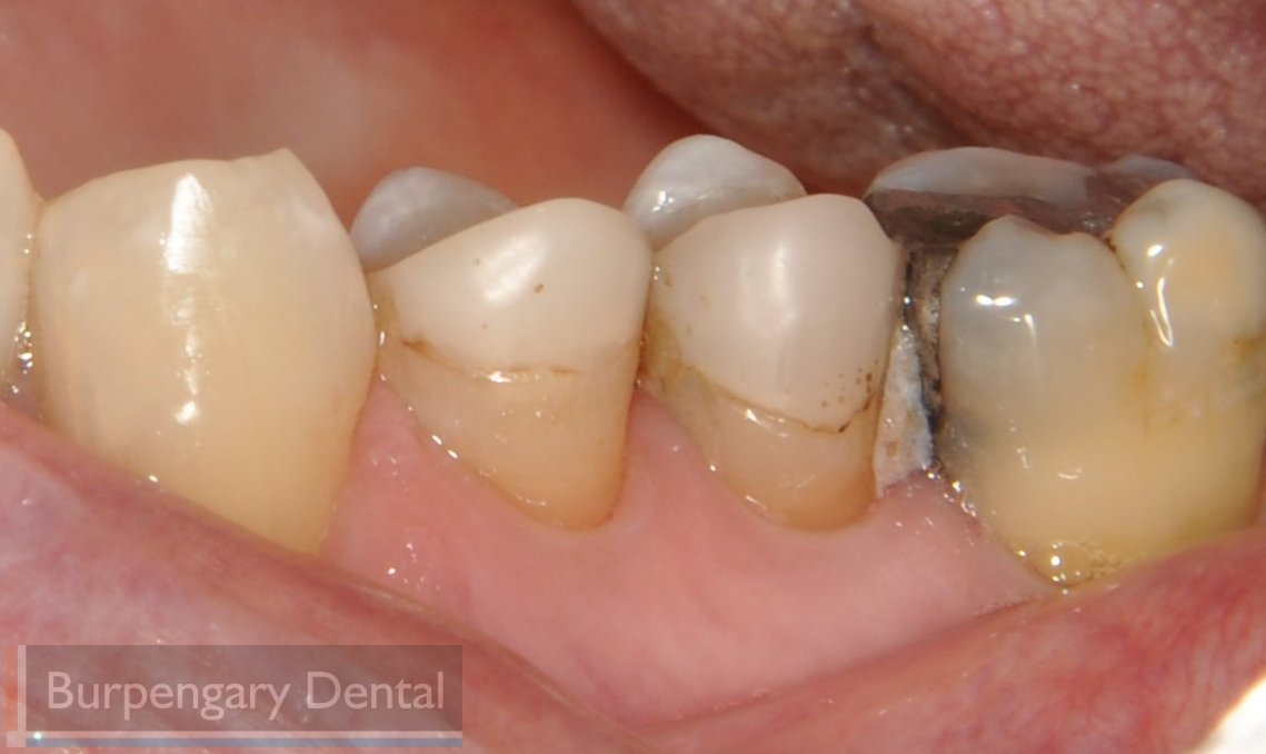 Patient before dental work image