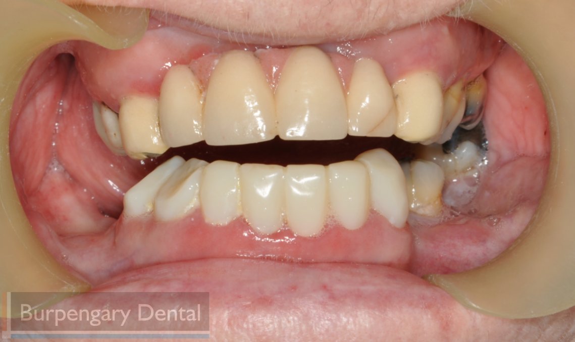 Patient after dental work image