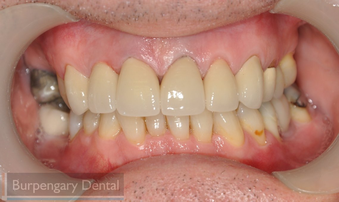 Patient after dental work image
