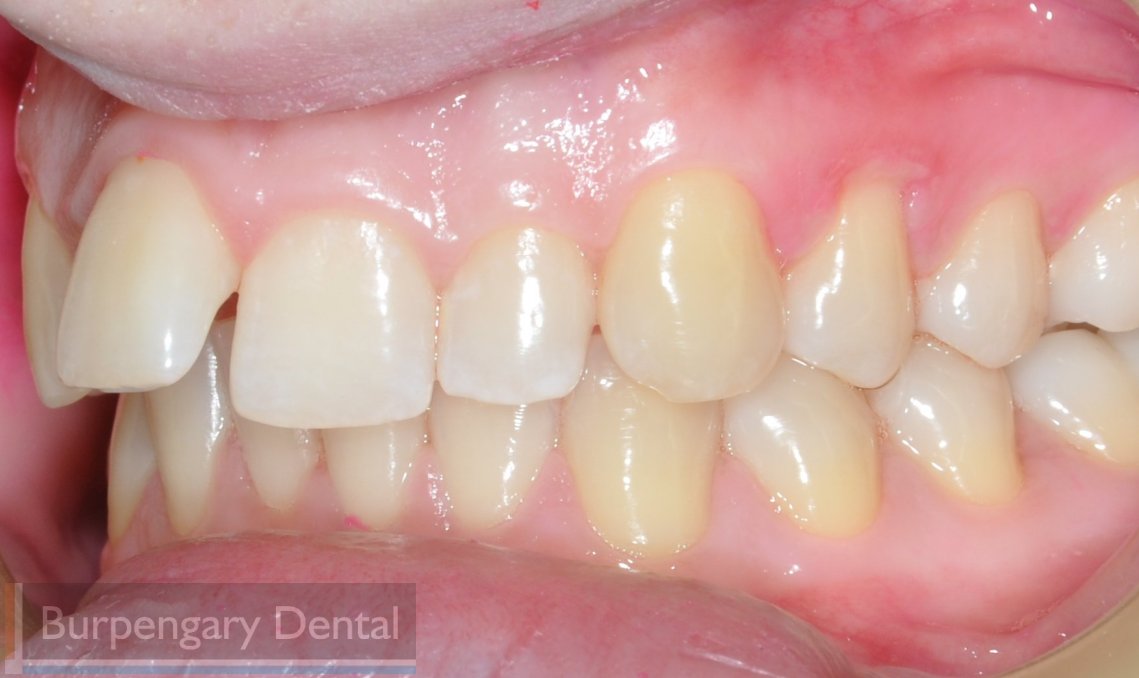 Patient before dental work image